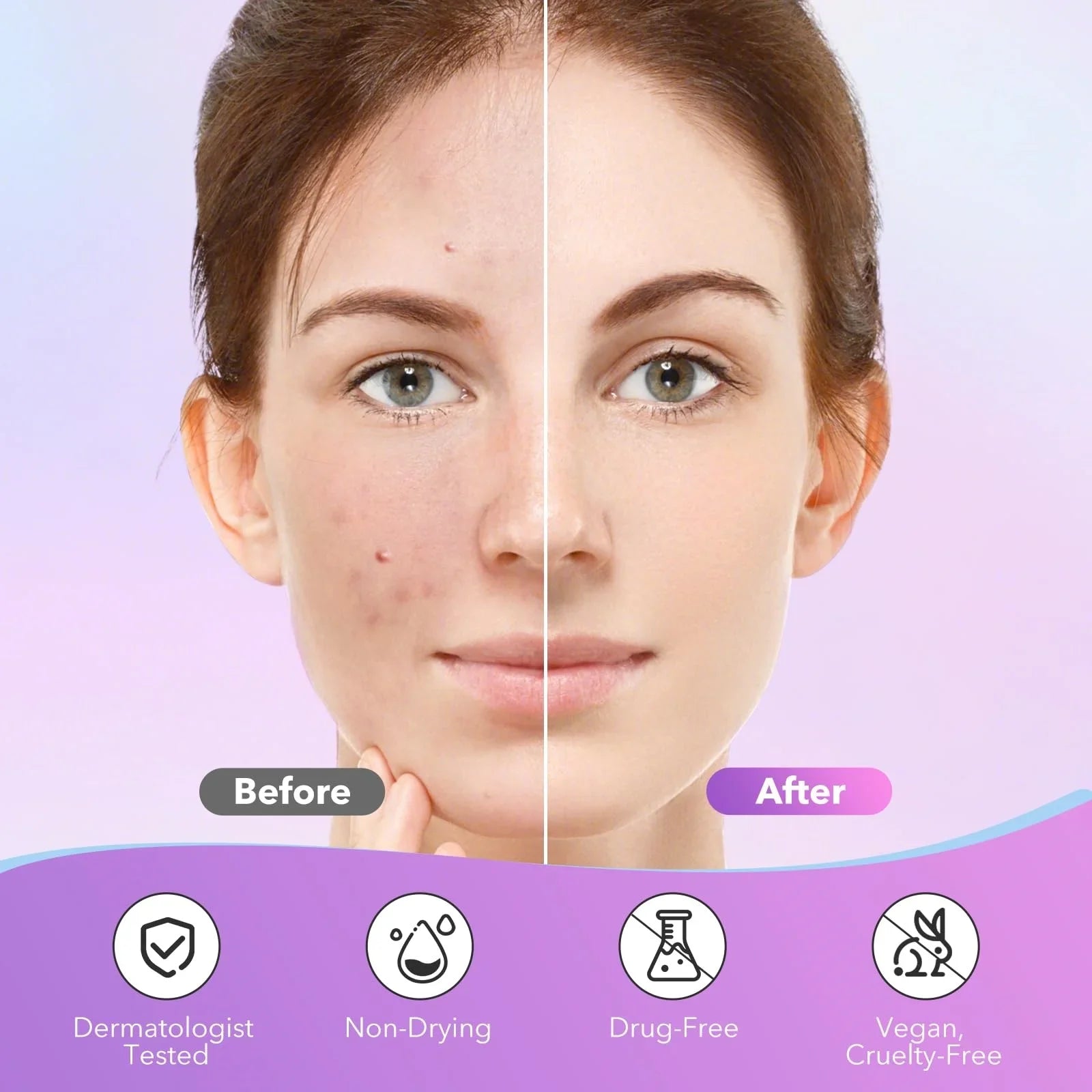 Starry Acne Cover Patches